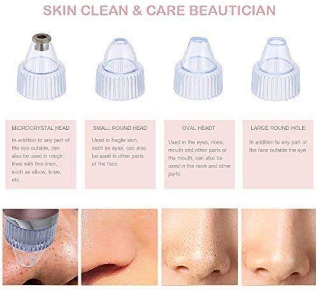 Derma Suction Pore Cleaning Device β¨ | Blackhead Remover Vacuum π USB Rechargeable π